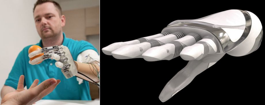 My-Hand-Bionic-hand-by-Institute-of-Biorobotics_4