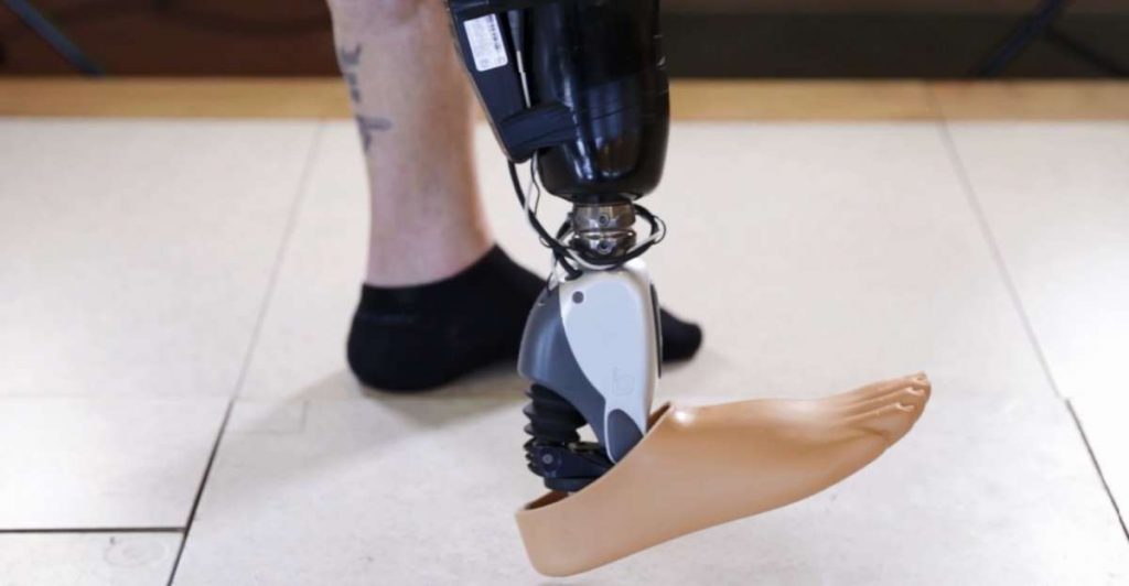 ossur_sensor_controlled_bionic_foot