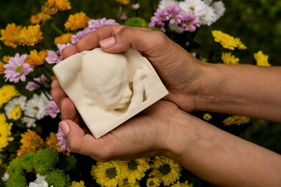 in-Utero-3D-printed-baby-scan_2